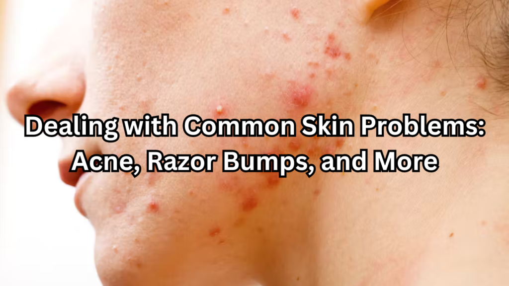 Common Skin Problems