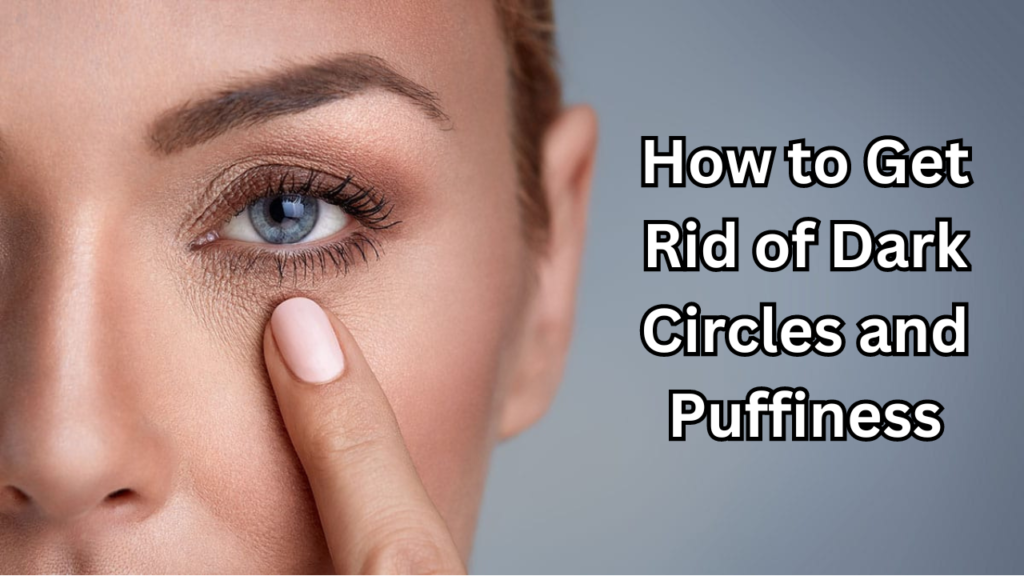 Dark Circles and Puffiness