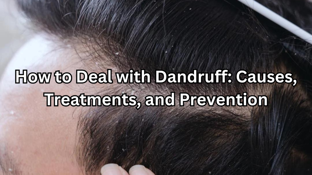 Deal with Dandruff