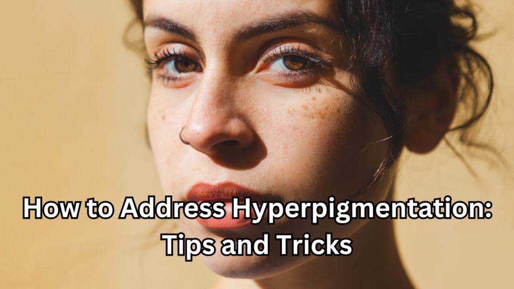 Hyperpigmentation