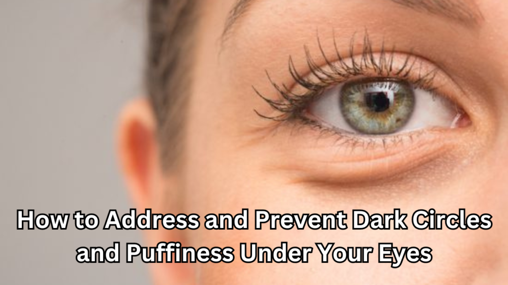 Prevent Dark Circles