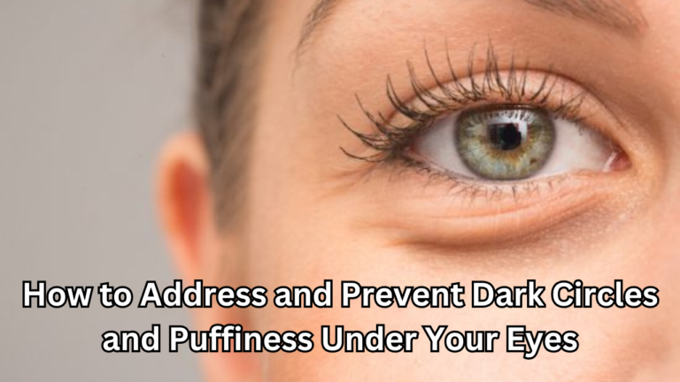 Prevent Dark Circles